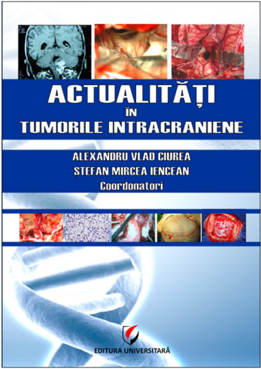 Actualităţi în tumorile intracraniene