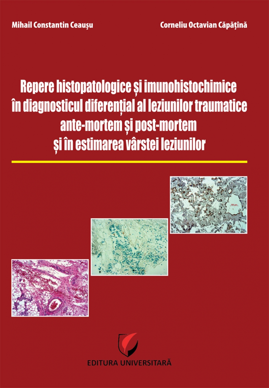 Repere histopatologice si imunohistochimice in diagnosticul diferential al leziunilor traumatice antemortem si postmortem si in estimarea varstei leziunilor